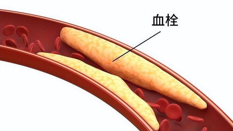  血型不是命运的判决书，而是身体在轻声告诉你什么 健康养生